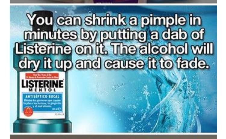 Drying up a  pimple with listerine